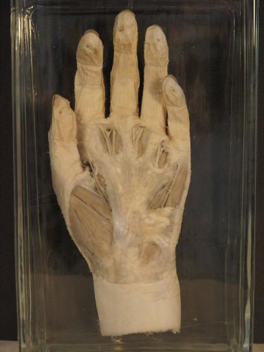 Hand-Präparat