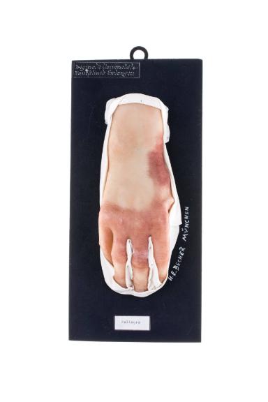 Pellagra