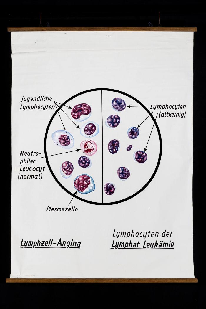 Differentialdiagnose im Blutausstrich