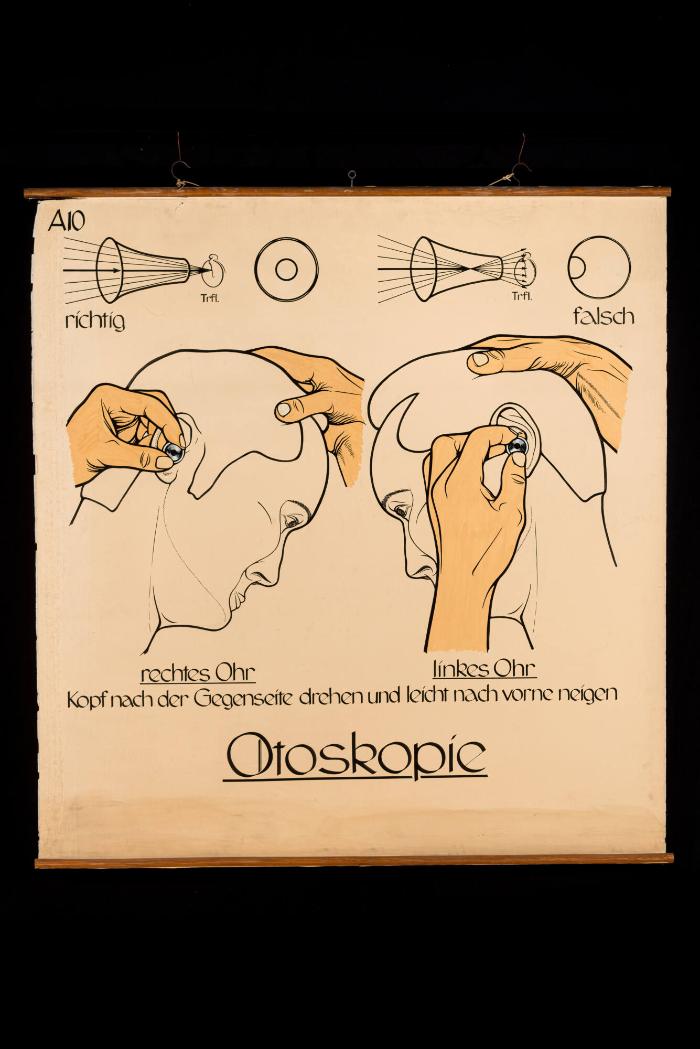 Ohrspiegelung (Otoskopie)