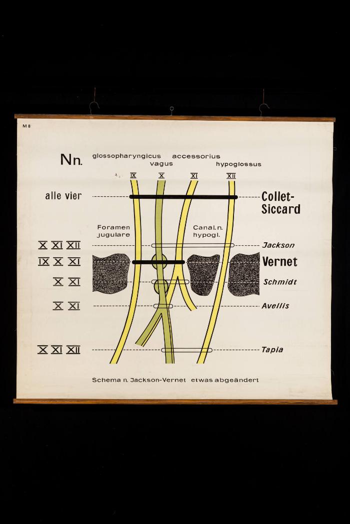 Der schematische Verlauf der kaudalen Hirnnerven (IX–XII) am Austritt aus der Schädelbasis (IX–XII)