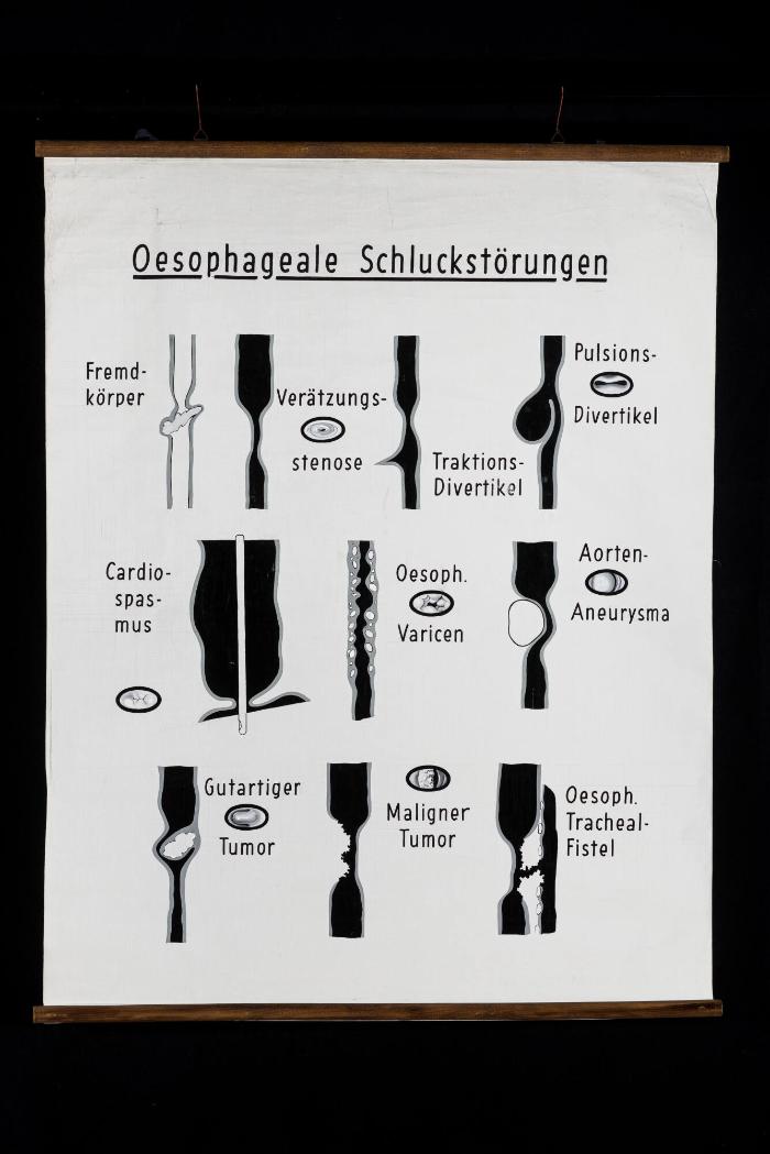 Oesophageale Schluckstörungen