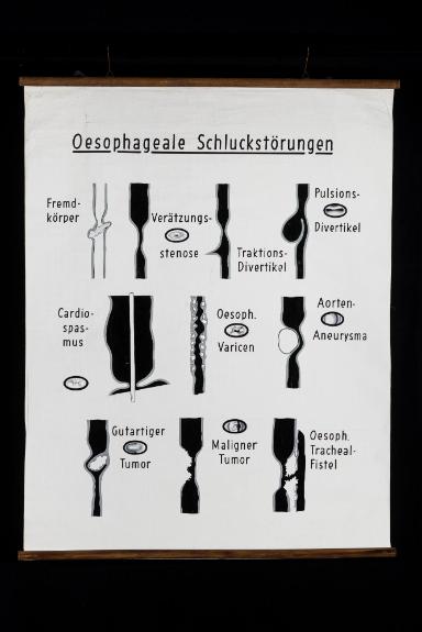Oesophageale Schluckstörungen
