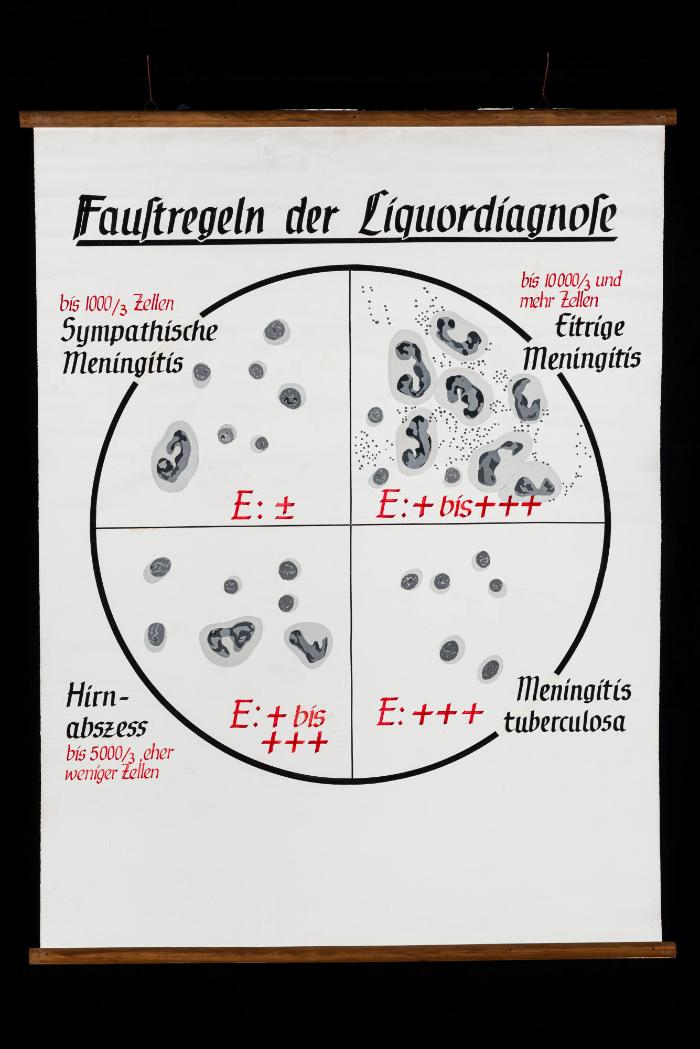 Faustregeln der Liquordiagnose (Diagnose im Hirnwasser)