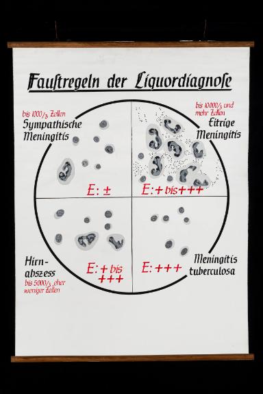 Faustregeln der Liquordiagnose (Diagnose im Hirnwasser)