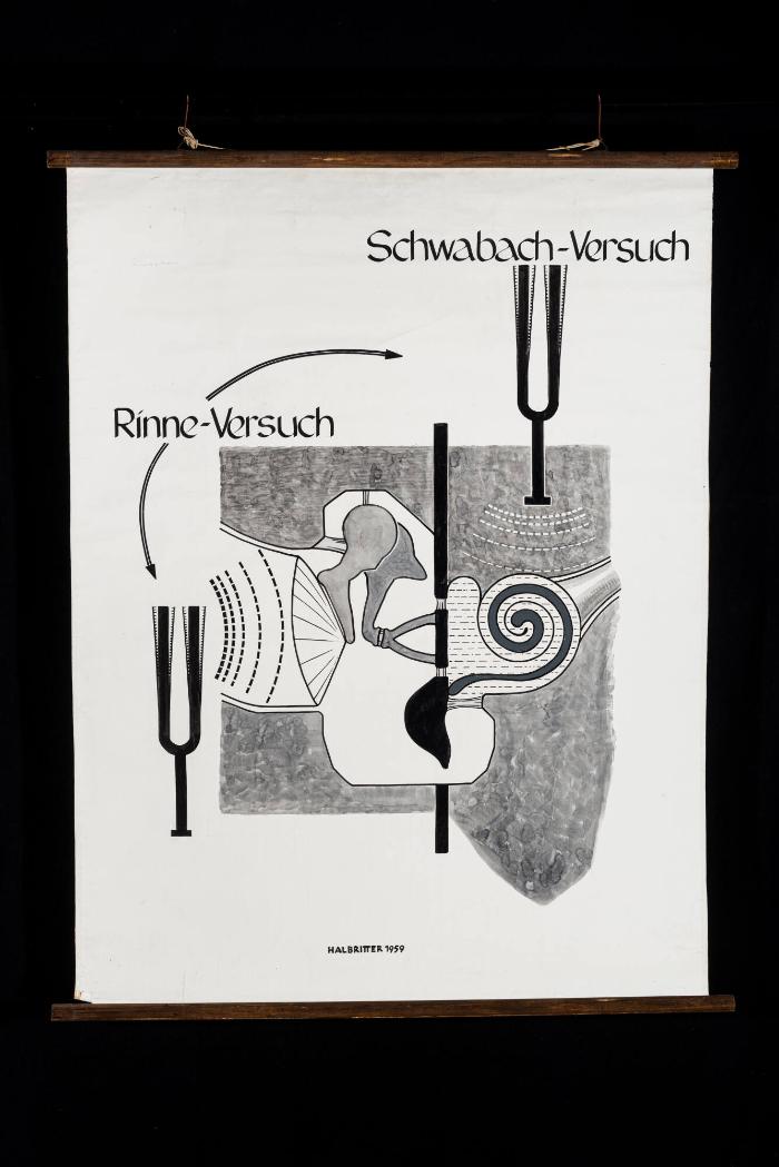 Schwabach-Versuch und Rinne-Versuch