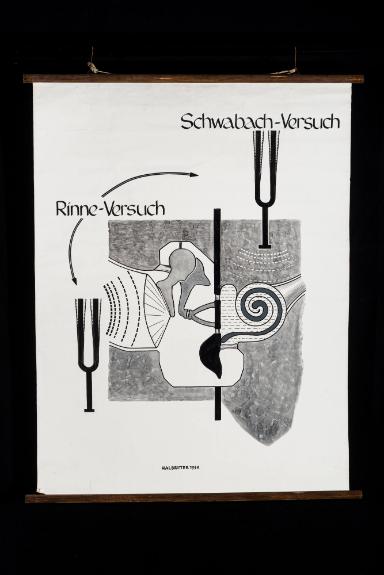 Schwabach-Versuch und Rinne-Versuch