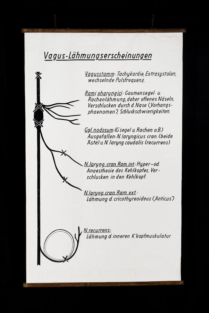 Vagus-Lähmungserscheinungen