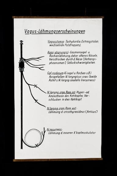 Vagus-Lähmungserscheinungen