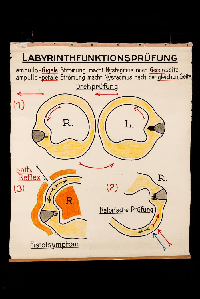 Labyrinthfunktionsprüfung