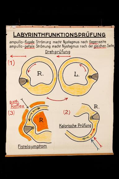 Labyrinthfunktionsprüfung