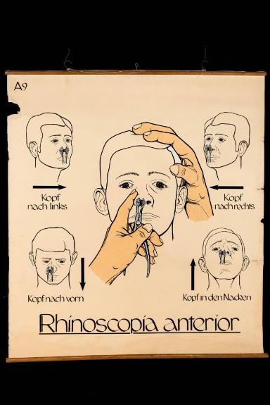Vordere Naseninspektion (Rhinoscopia anterior)