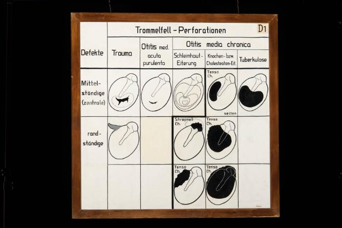 Trommelfell-Perforationen