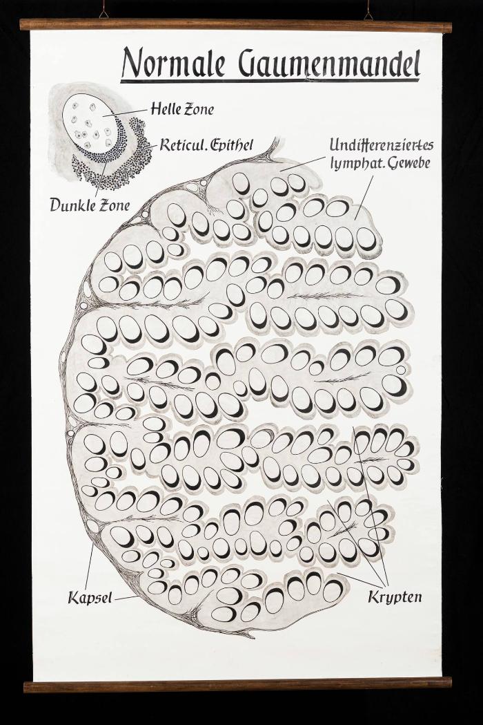 Schematische histologische Darstellung der normalen Gaumenmandel (Tonsilla palatina)