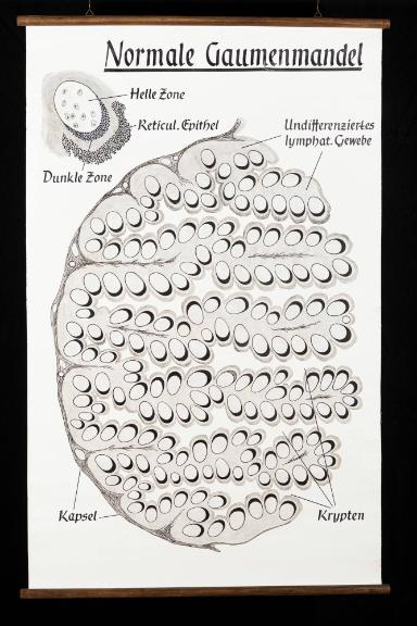 Schematische histologische Darstellung der normalen Gaumenmandel (Tonsilla palatina)