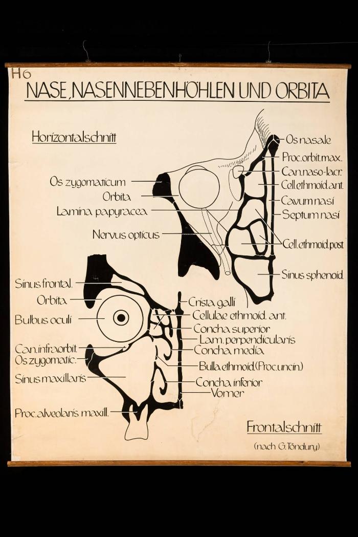 Schematische anatomische Darstellung der Nasenhaupt- und Nasennebenhöhlen sowie der Augenhöhlen (Orbita)