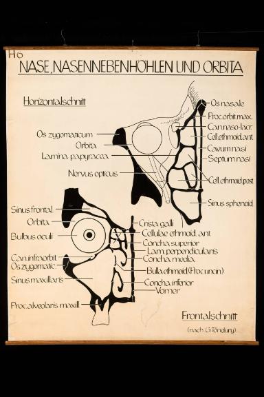 Schematische anatomische Darstellung der Nasenhaupt- und Nasennebenhöhlen sowie der Augenhöhlen (Orbita)