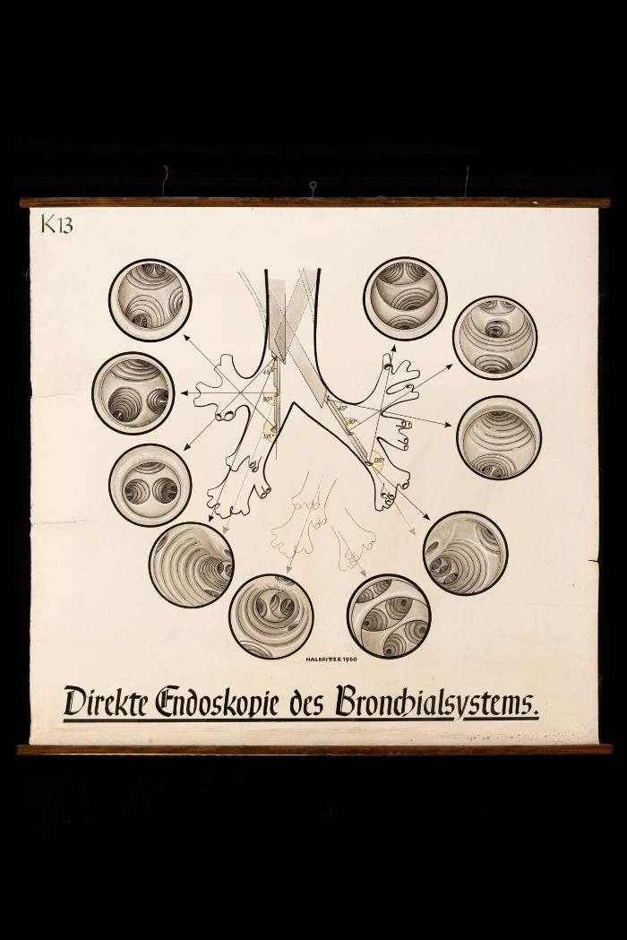 Direkte Endoskopie des Bronchialsystems