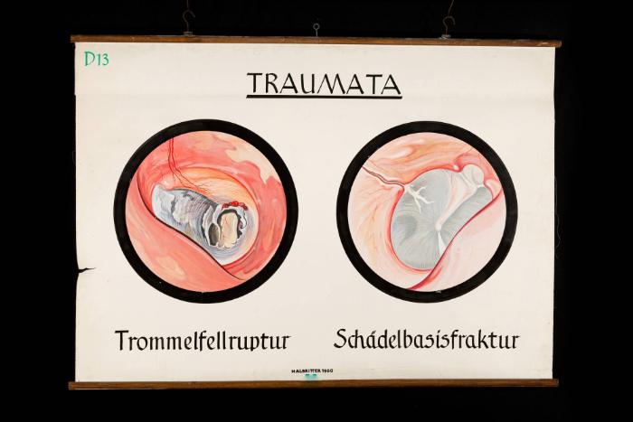 Traumata