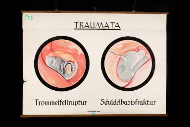 Traumata