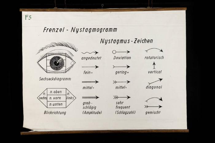 Frenzel-Nystagmogramm
