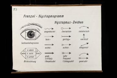 Frenzel-Nystagmogramm