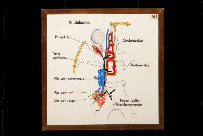 Der schematische Verlauf des Nervus abducens (VI. Hirnnerv) im Bereich der Schädelbasis