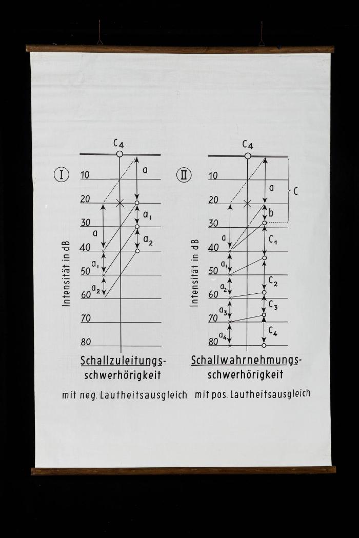 Schallzuleitungsschwerhörigkeit und Schallwahrnehmungsschwerhörigkeit