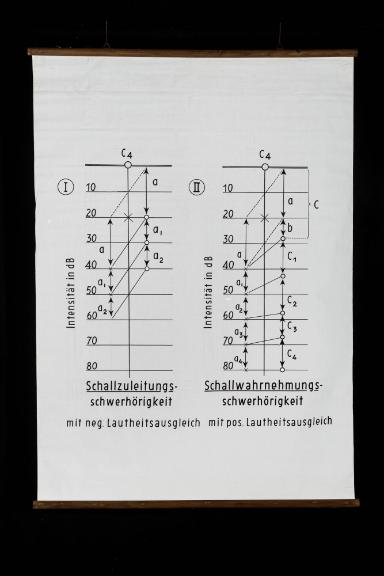 Schallzuleitungsschwerhörigkeit und Schallwahrnehmungsschwerhörigkeit
