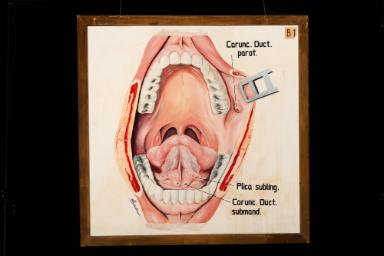 Anatomische Darstellung von Normalbefunden der Mundhöhle, des Mundbodens, der Zunge und des Mundrachens (Oropharynx)
