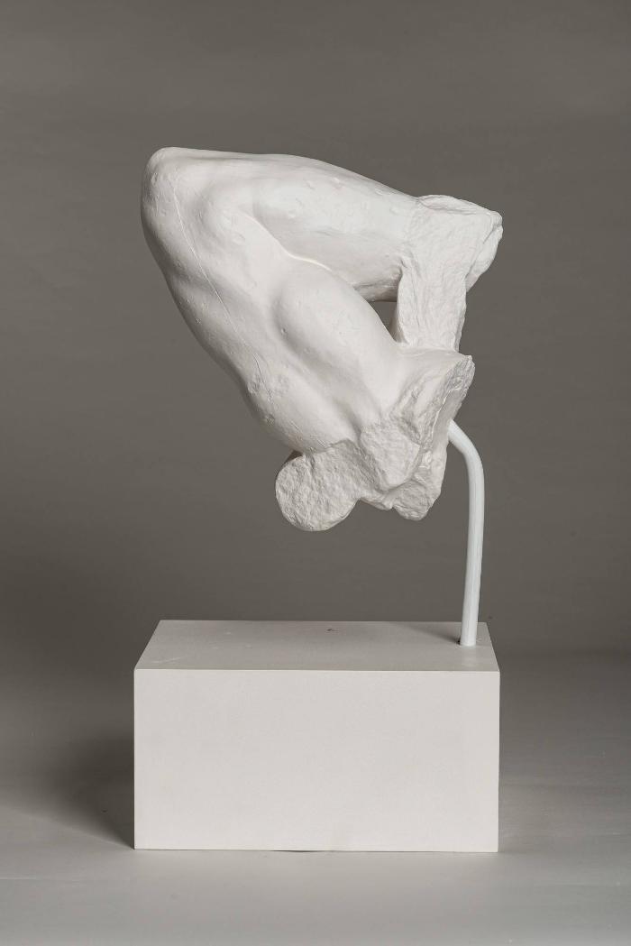 rechter Arm des Laokoon aus der gleichnamigen Statuengruppe, sog. Pollak'scher Arm