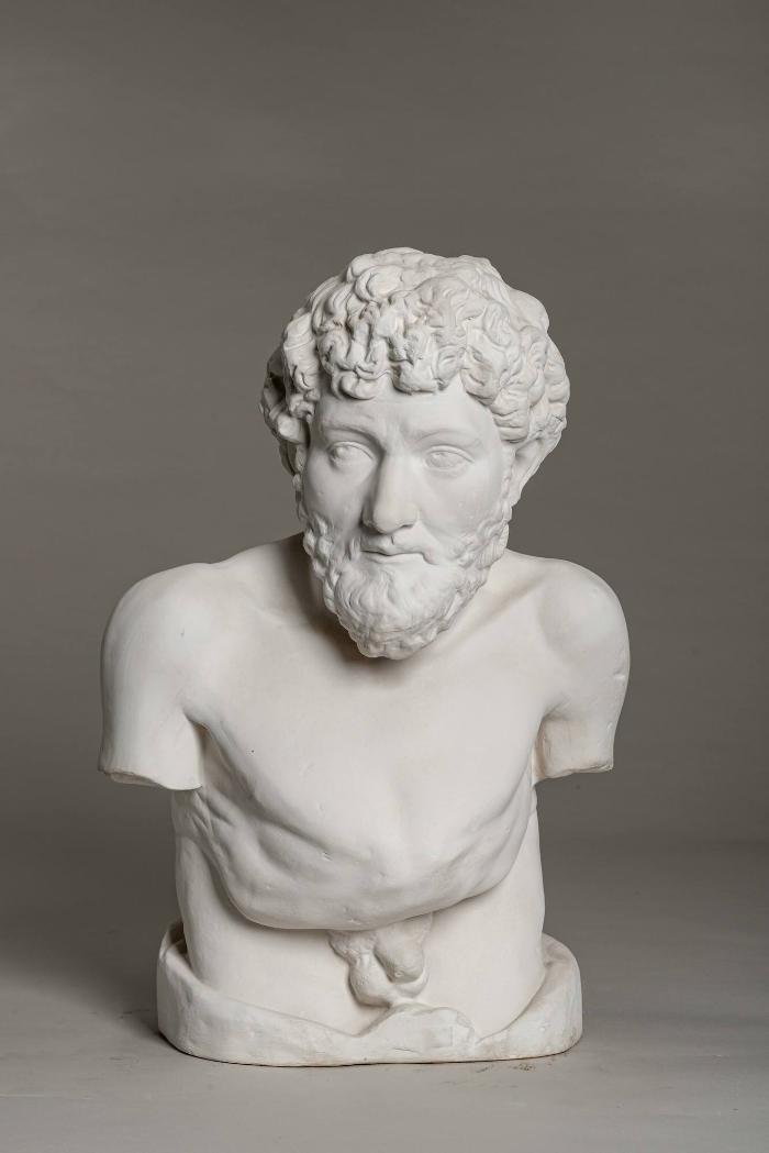 Torso der Porträtstatue eines verwachsenen Mannes, sog. Äsop