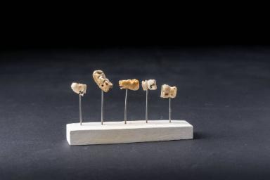 Schaumodell mit fünf Zahnporthesen